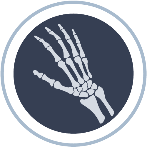 Hand and Wrist Surgery Icons