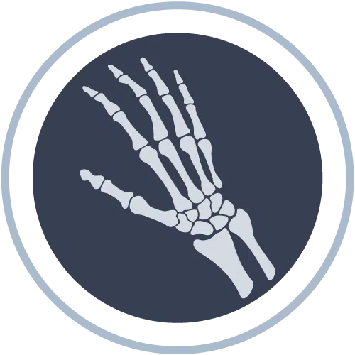 Hand and Wrist Surgery Icons