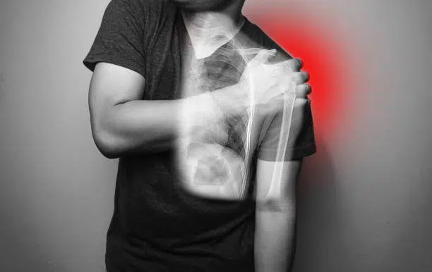 Man is suffering from shoulder fracture