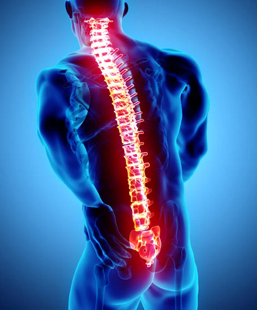 Medical Illustration of man suffering from chronic back pain