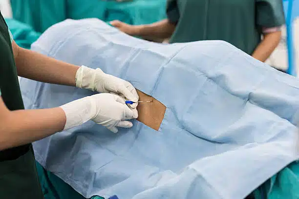 Surgeons injecting some anesthesia to the patient before the Spinal Laminectomy Surgery 