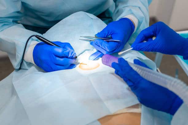 Surgeons doing some Abscess Incision and Drainage surgery in the operating room 