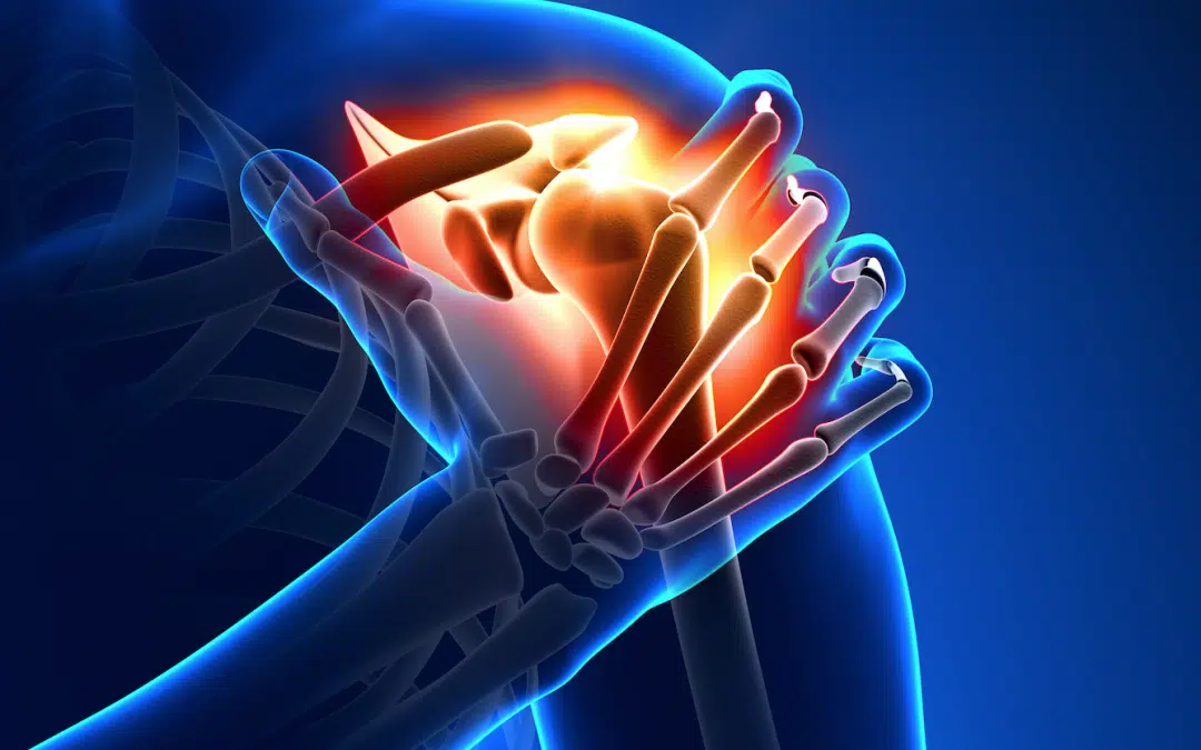 3D medical illustration of a human with shoulder injury 