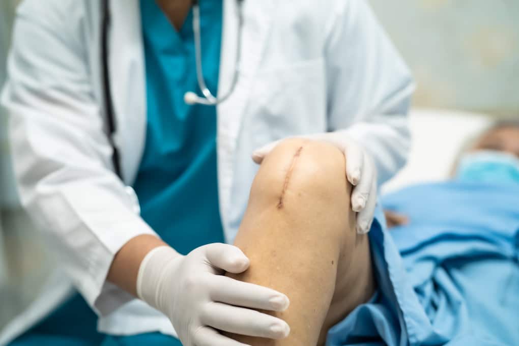 Patient having a knee surgery at the surgery center.