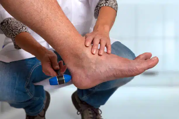 doctor examines the achilles tendon reflex of the patiënt with a reflex hammer.