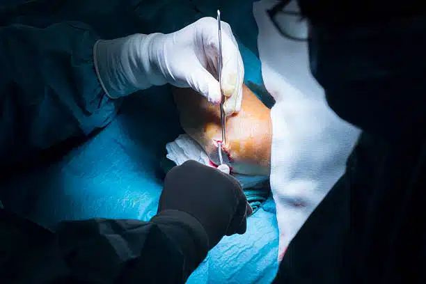 Surgeon doing some Elbow Arthroscopy surgery.