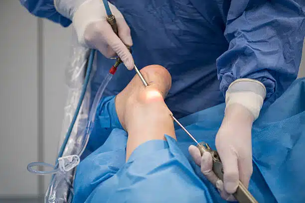An orthopedic surgeon performs surgery on the Achilles tendon of a patient.